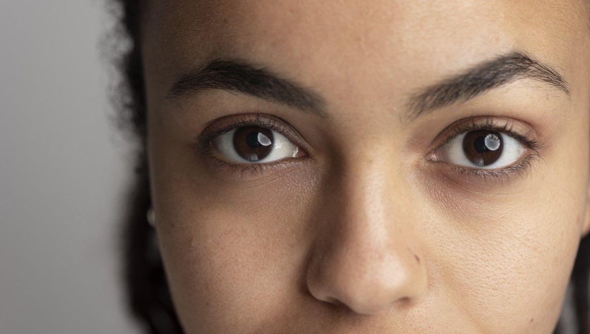 ¿Qué son y causas de las ojeras?